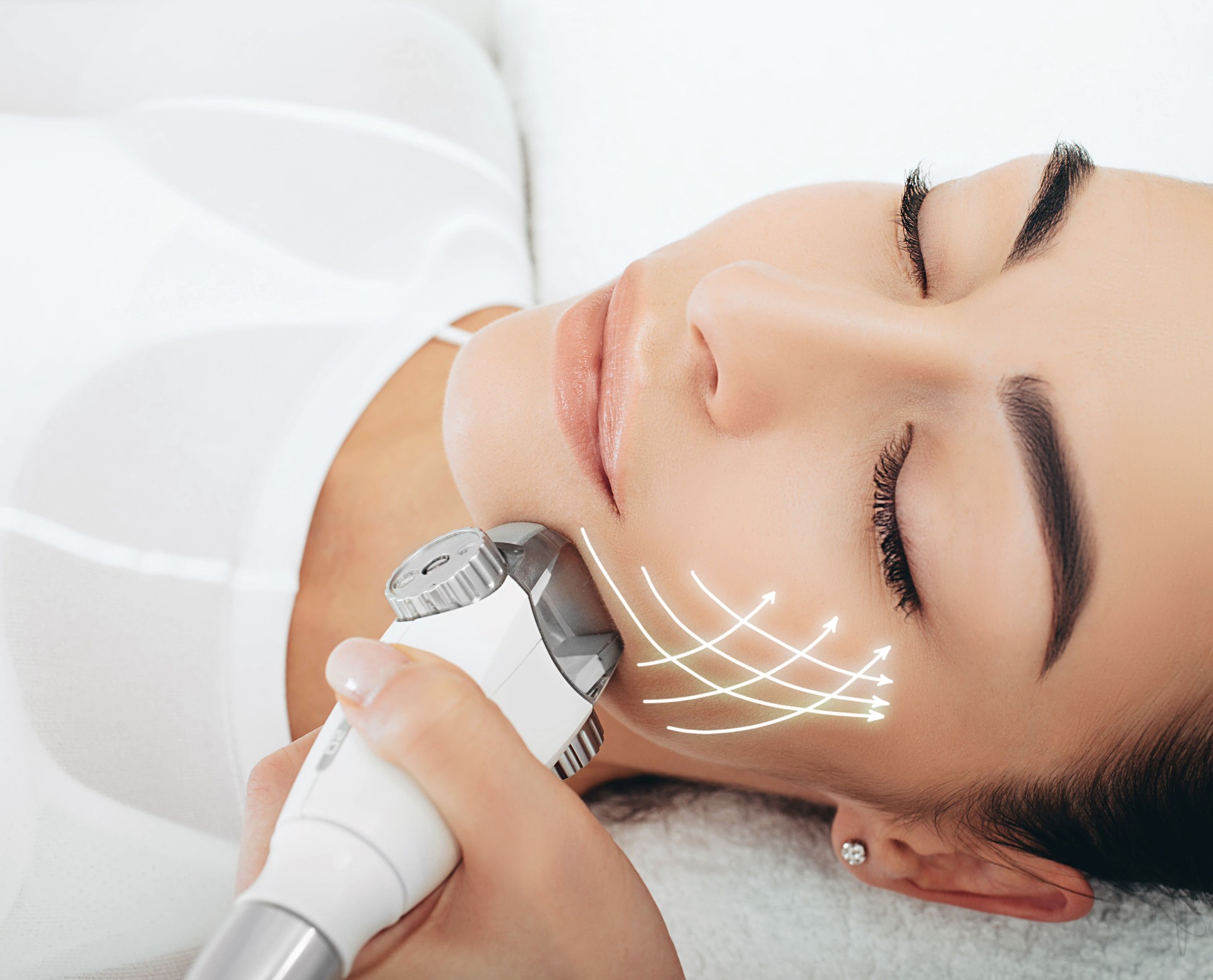 face lifting lpg massage , the woman's face shines with youth and freshness. Anti-aging face contour correction, lifting arrows